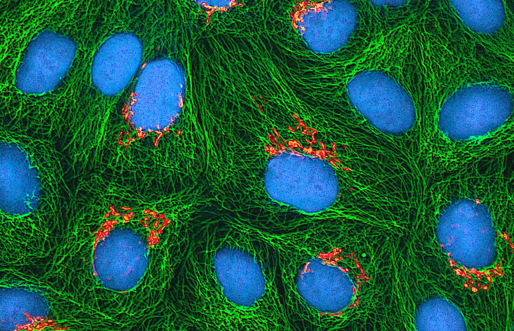 Brassage Interchromosomique Ou Intrachromosomique Pearltrees